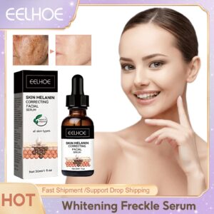 EELHOE Whitening Face Serum Fade Dark Spot Freckle Remove Pigment Melanin Brighten Improve Roughness Niacinamide Facial Essence