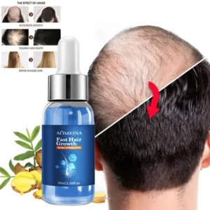 Fast Hair Growth Hair Growth Oil Effective Baldness Repair Hereditary Hair Loss Postpartum Hair Loss Seborrheic Hair Anti Loss