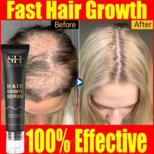 Fast Hair Regrowth Products Hair Thinning Baldness Treatment Prevent Seborrheic Alopecia Postpartum Hair Loss Repair Care Serum