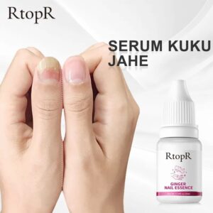Ginger Nail Fungus Treatment Repair Liquid Armor Sterilization Treatment Onychomycosis Remover Nail Care Tool Beauty Health