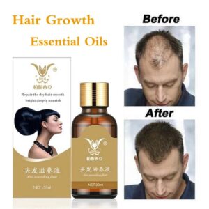 Hair Care Hair Growth Essential Oils Essence Original Authentic 100% Hair Loss Liquid Health Care Beauty Dense Hair Growth Serum