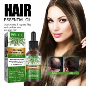 Hair Growth Essence Oil Fast Repair Baldness Hereditary Postpartum Seborrheic Hair Loss Hair Regrowth Treatment Serum Men Women