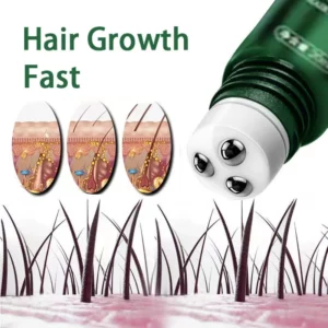 Hair Growth Oil Fast Hair Growth Effective Baldness Repair Hereditary Postpartum Hair Loss Seborrheic Hair Loss