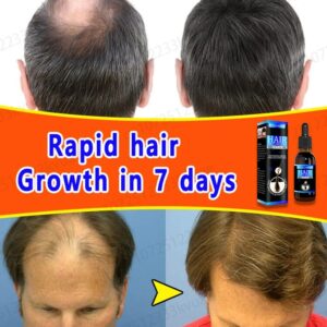 Hair growth solution can quickly and effectively grow hair, repair hereditary hair loss, postpartum hair loss, and seborrheic al