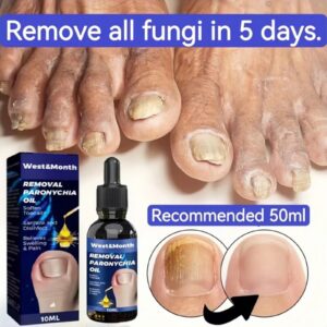 Nail Treatment Feet Care Essence Nail Foot Whitening Toe Nail Fungus Removal Gel Anti Infection