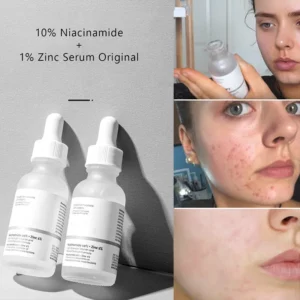 Original Niacinamide 10% Zinc 1% B5 Essence Fruit Acid 30% Salicylic Caffeine Vitamin Moisturizes Tightens Soften Skin Care
