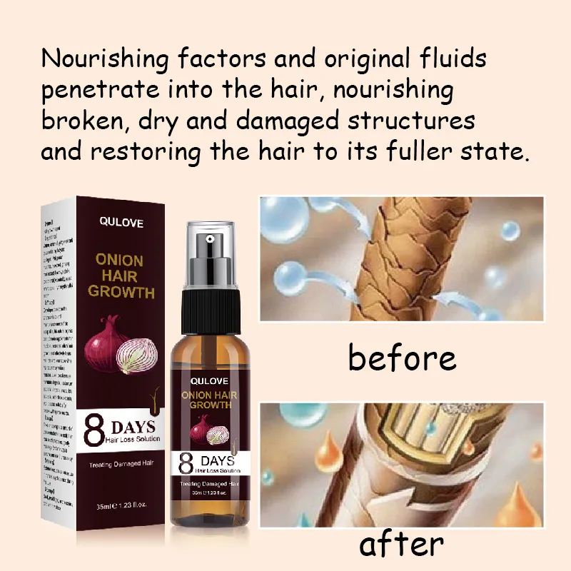 Powerful Hair Growth Serum Onion Spray Anti Hairs Loss Products Treatment Essence Repair Nourish Roots Regrowth For Men Women - Image 3