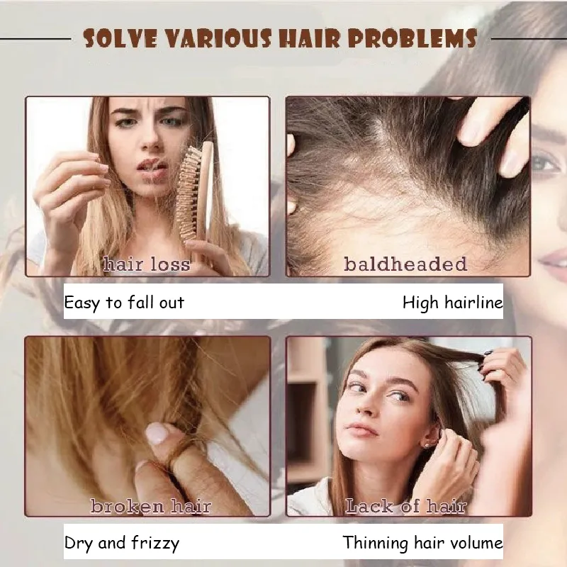 Powerful Hair Growth Serum Onion Spray Anti Hairs Loss Products Treatment Essence Repair Nourish Roots Regrowth For Men Women - Image 4