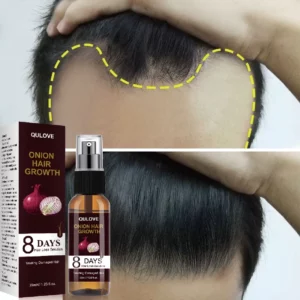 Powerful Hair Growth Serum Onion Spray Anti Hairs Loss Products Treatment Essence Repair Nourish Roots Regrowth For Men Women
