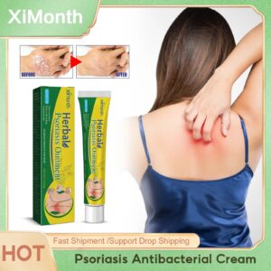 Psoriasis Antibacterial Cream Relieve Rash Urticaria Desquamation Fungus Treatment Anti Itching Dermatitis Eczematoid Ointment