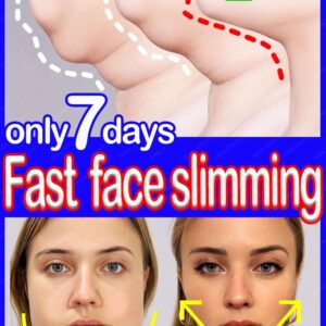 V Shape Face Slimming Cream Remove Double Chin